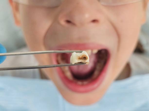 Best Emergency Broken Tooth Repair in Oakley, KS