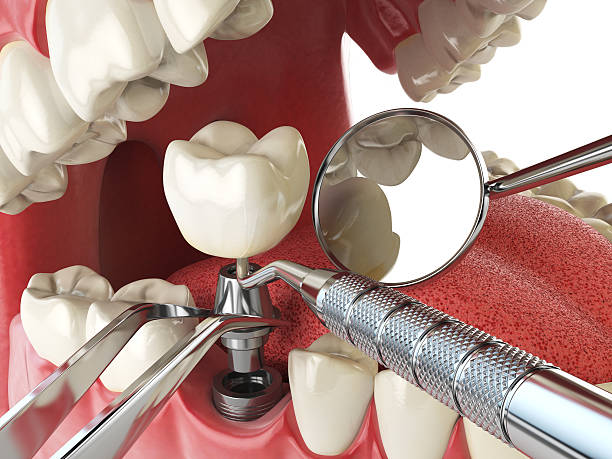 Best Weekend Emergency Dentist in Oakley, KS